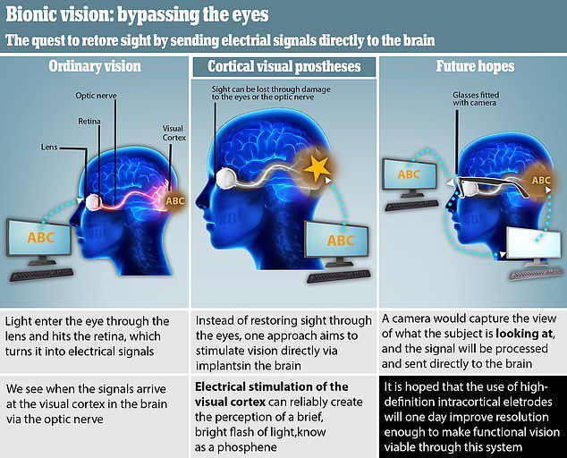 大脑植入电极恢复猴子基本视力，该技术有望三年内造福盲人